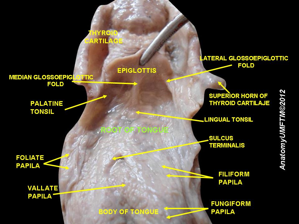File:Slide5uuu.JPG
