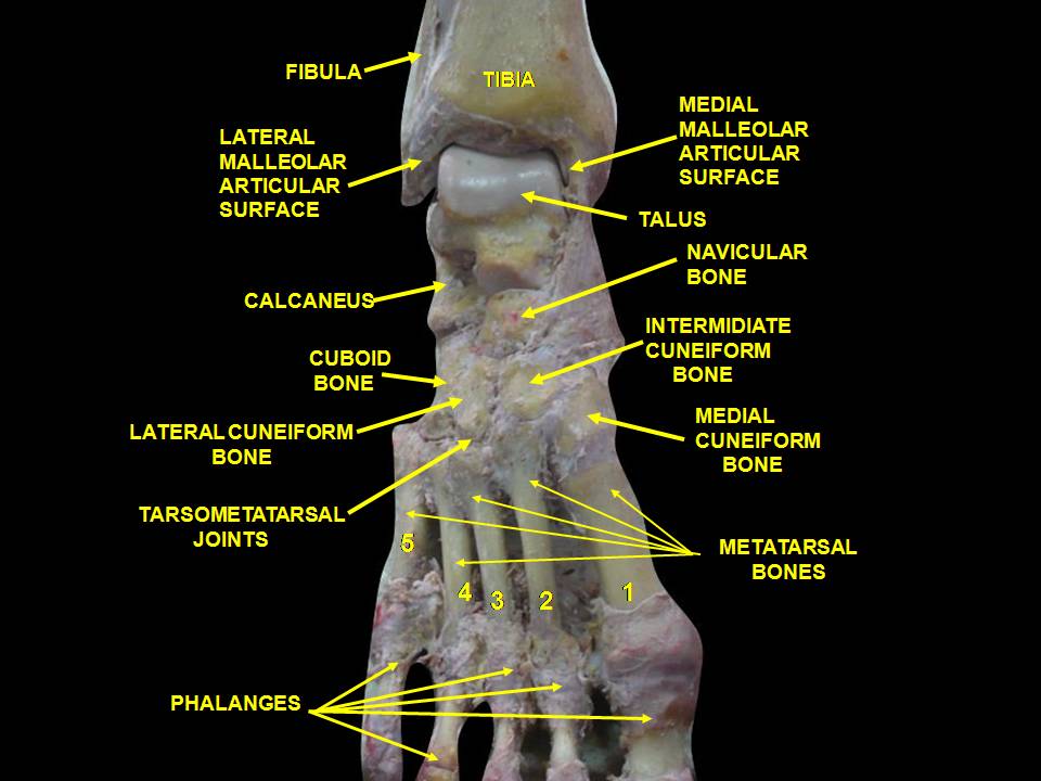 File:Slide2xzxzx.JPG