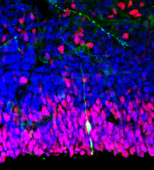 File:Neural stem cell.png