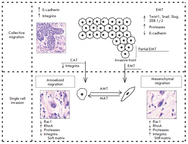 File:Patterns of cancer cell invasion.jpg