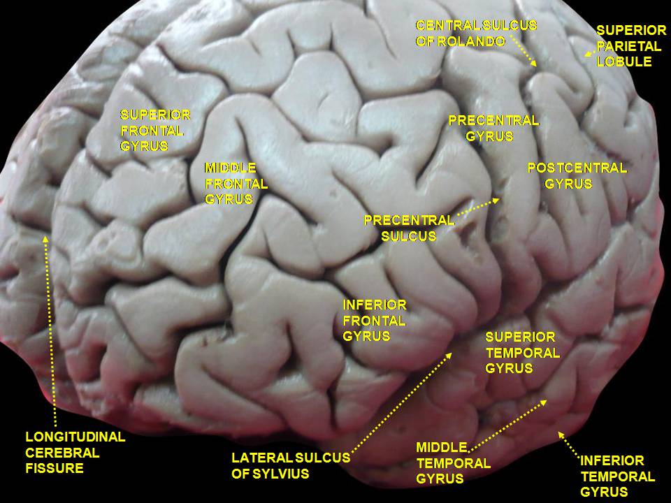 File:Slide2KLI.JPG