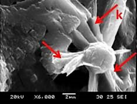 File:Thraustochytrids SEM.png