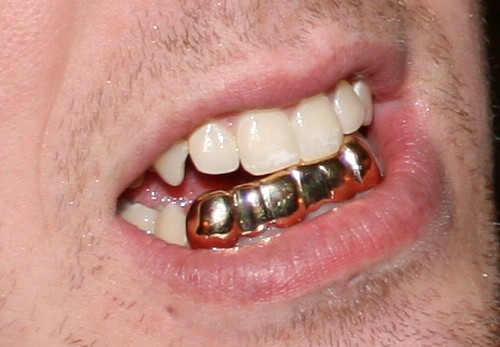 File:Grillz2.jpg