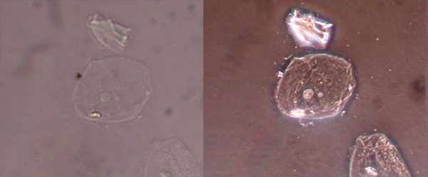 File:Brightfield phase contrast cell image.jpg