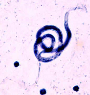File:Brugia malayi.JPG