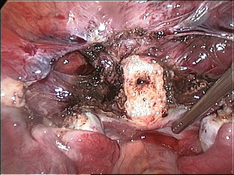 File:LASH.jpg