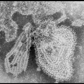 File:Mumps virus.jpg