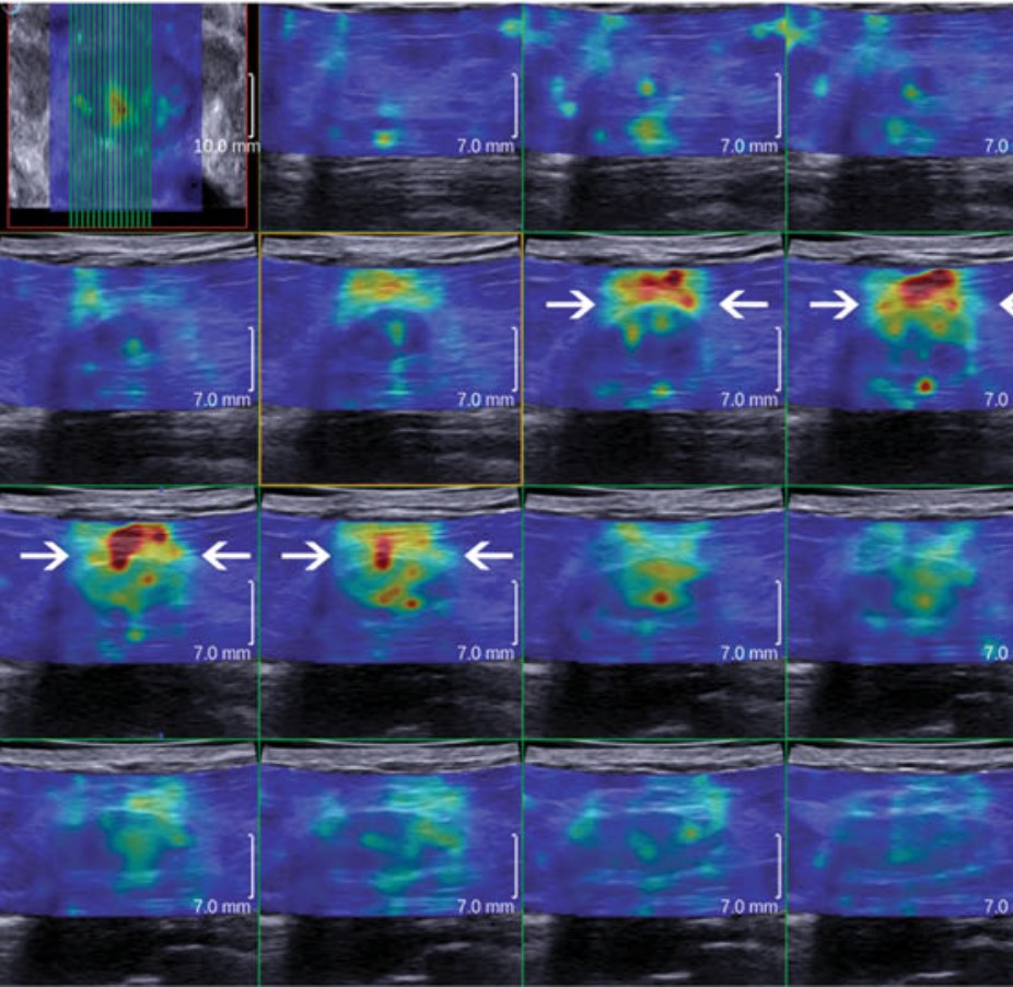 File:3D-SWE.jpg