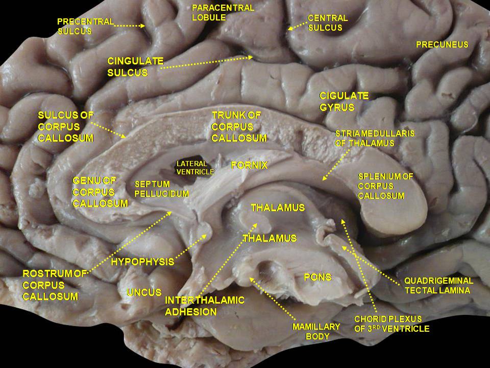 File:Slide4KLI.JPG
