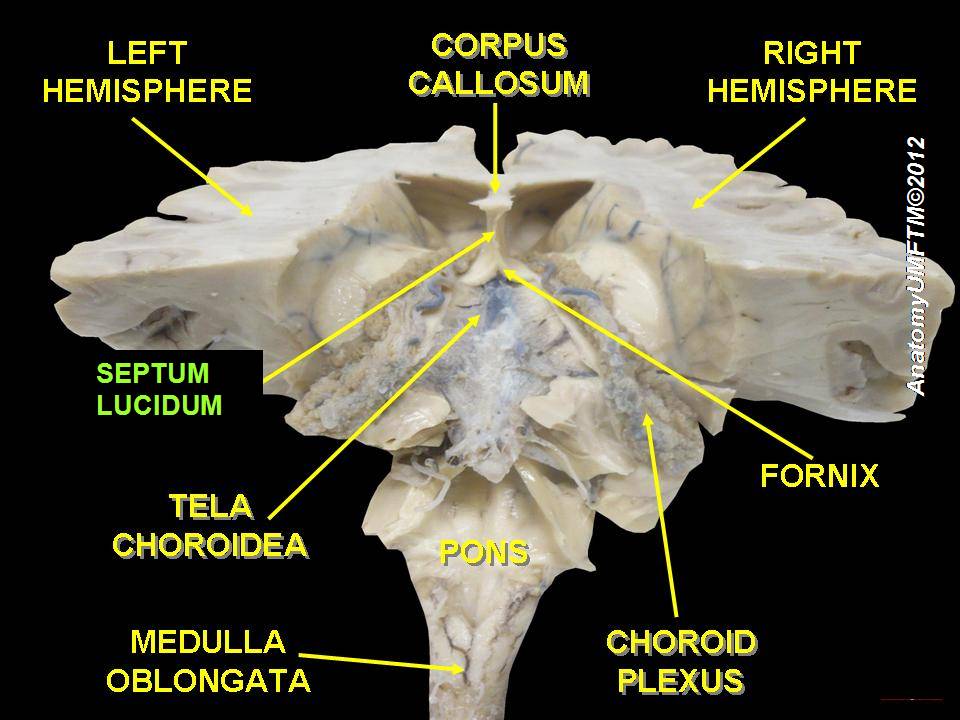 File:Slide5oo.JPG