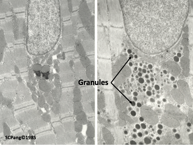 File:ANP Granules in a Mouse Model.png