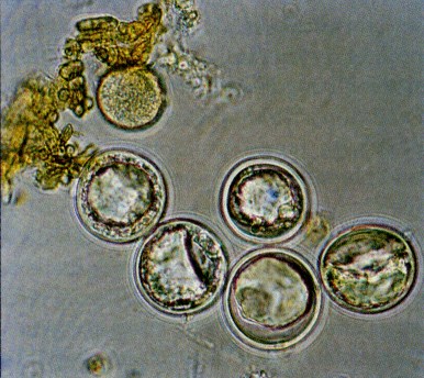 File:Entomophagamaimaiga azygospores.jpg