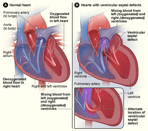 File:VSD image.jpg