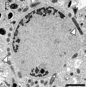 File:RG-373427877-Fig1B.png