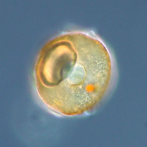 File:Arcella sp.jpg