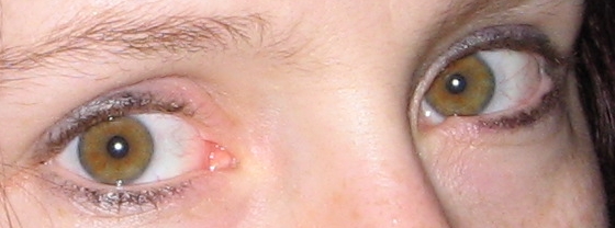 File:Amber eyes.JPG