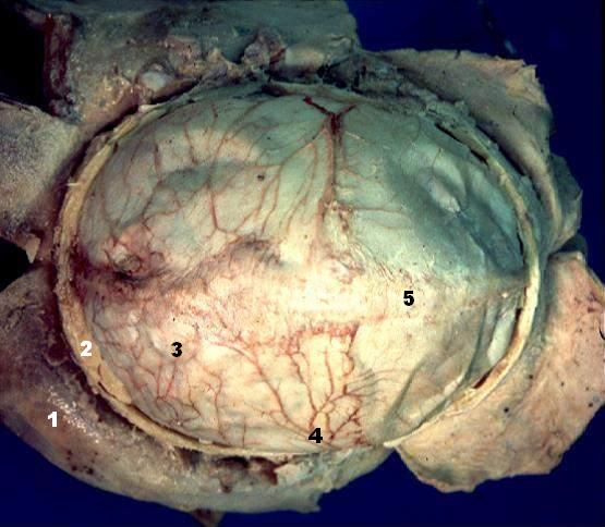 File:Human brain dura mater description.JPG