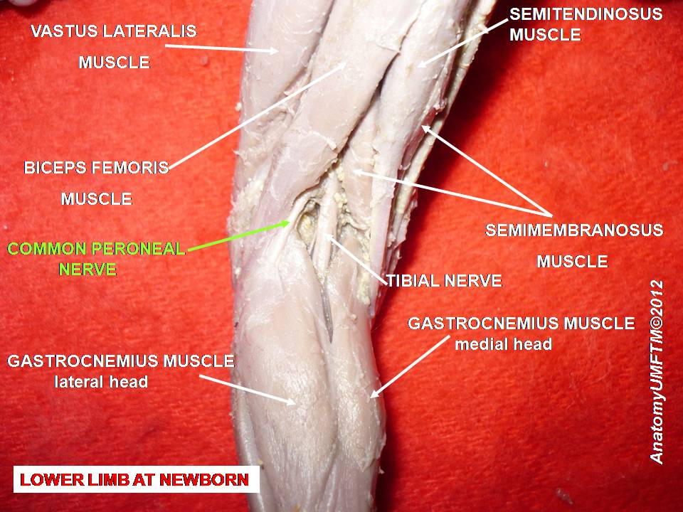File:Slide5j.JPG
