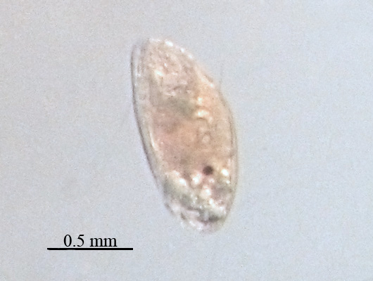 File:Balanus improvisus, cypris.jpg