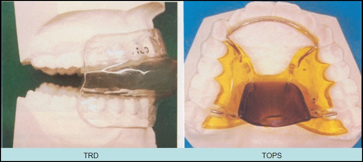 File:Avance mandibular.jpg