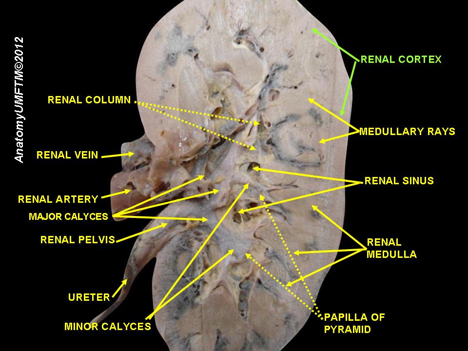 File:Slide24iii.JPG