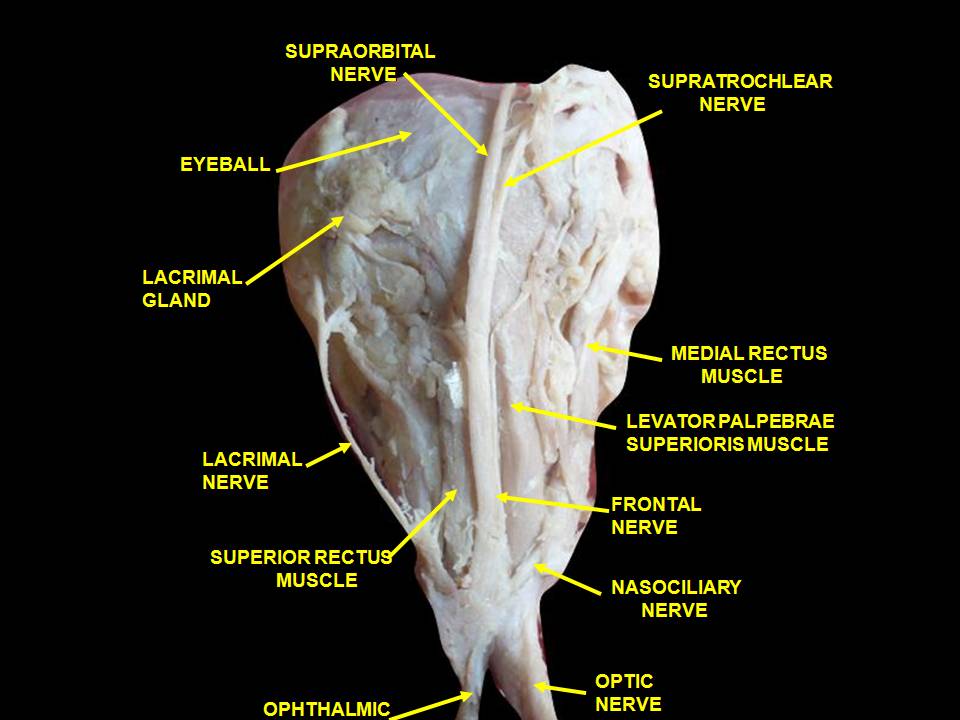 File:Slide5abab.JPG