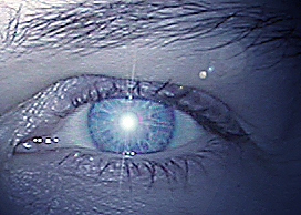 File:Human eye reflecting the sun.jpg