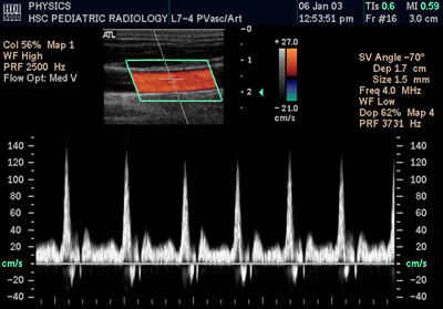 File:SpectralDopplerA.jpg