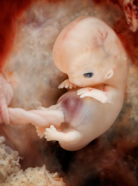 File:Embryo at 7-8 weeks from conception.png