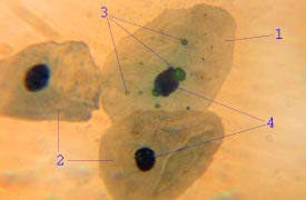 File:Chlamydia pneumoniae.jpg