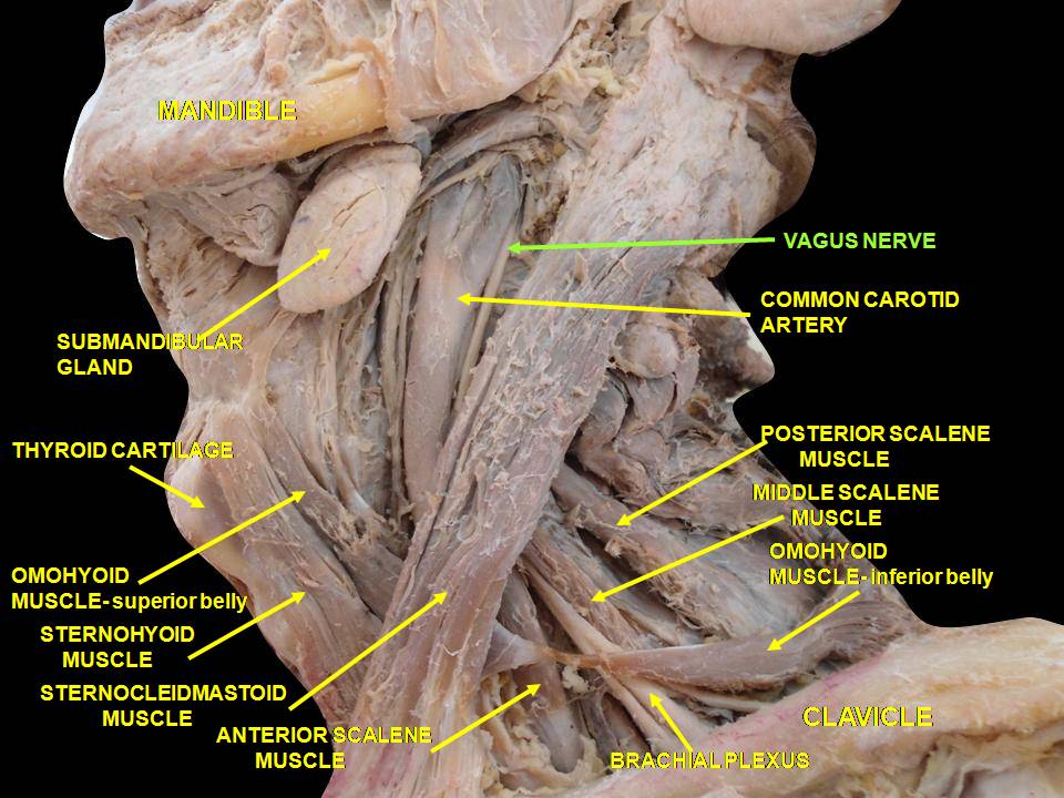 File:Slide6rom.JPG