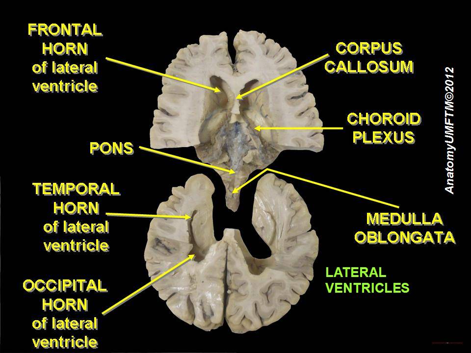 File:Slide4oo.JPG