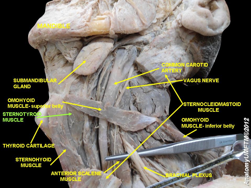 File:Slide3c.JPG