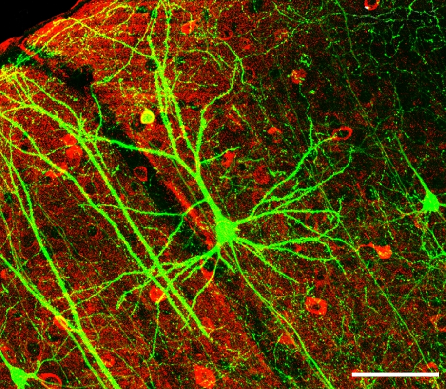 File:PLoSBiol4.e126.Fig6fNeuron.jpg