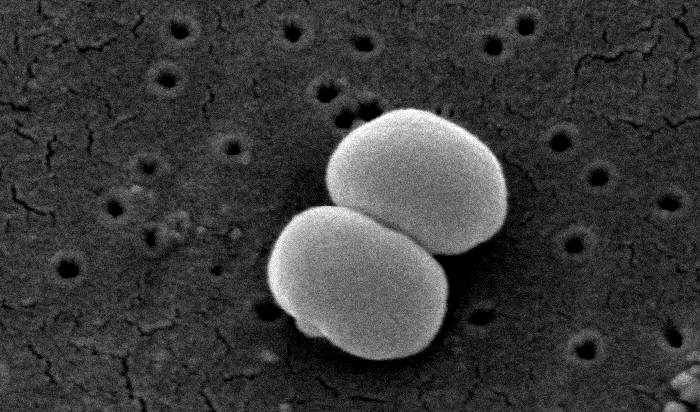 File:Staphylococcus epidermidis 01.png