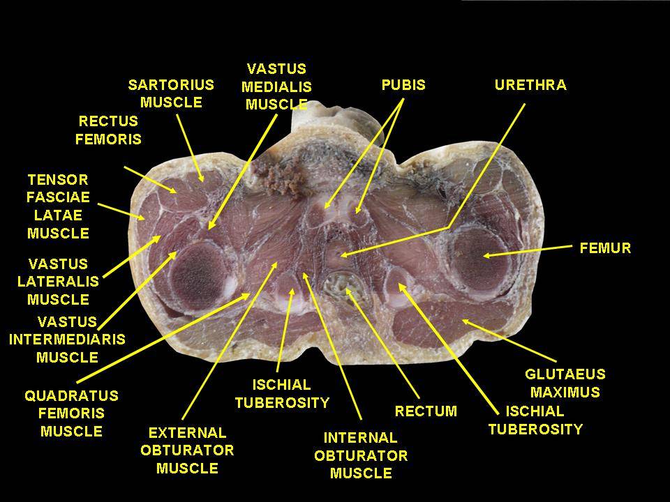 File:Slide12BLA.JPG