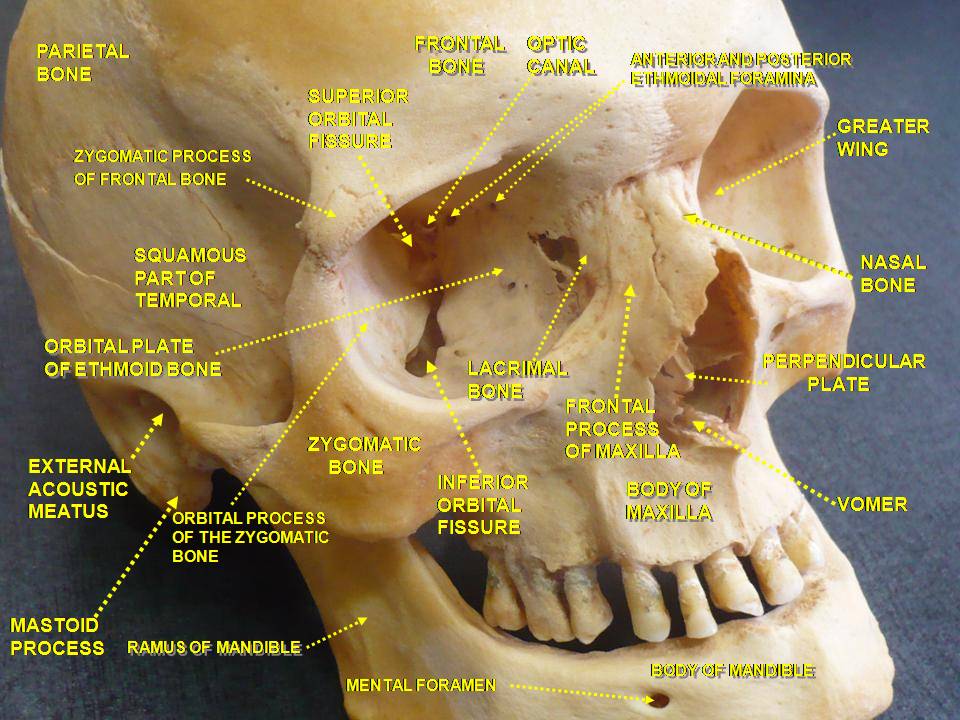 File:Slide4fen.JPG