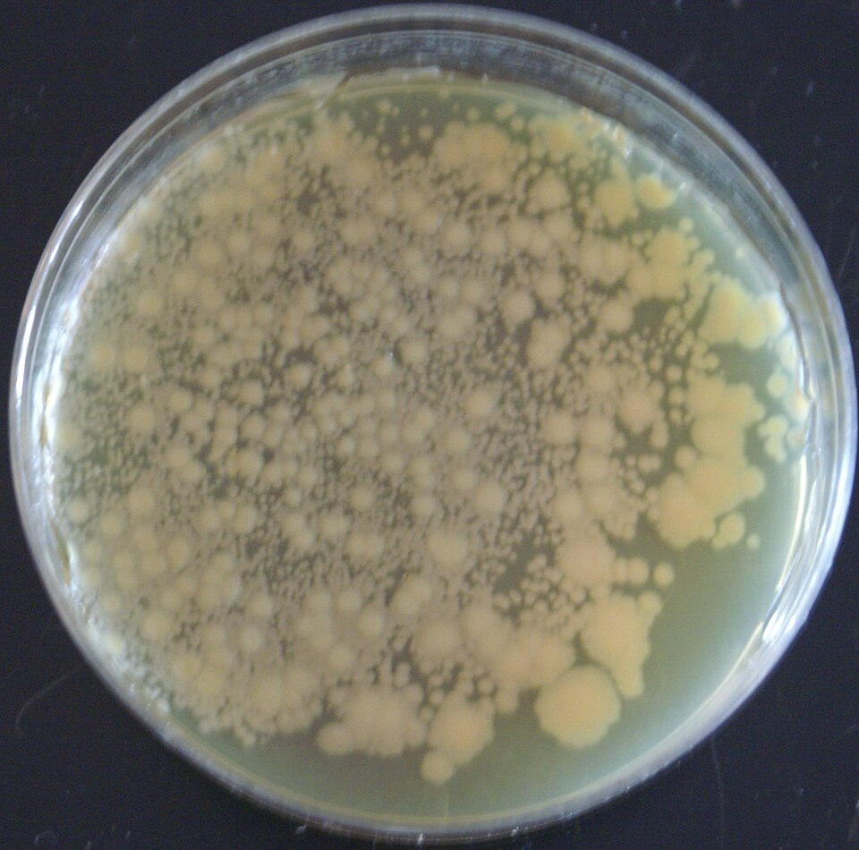 File:PLGO under ambient light.jpg