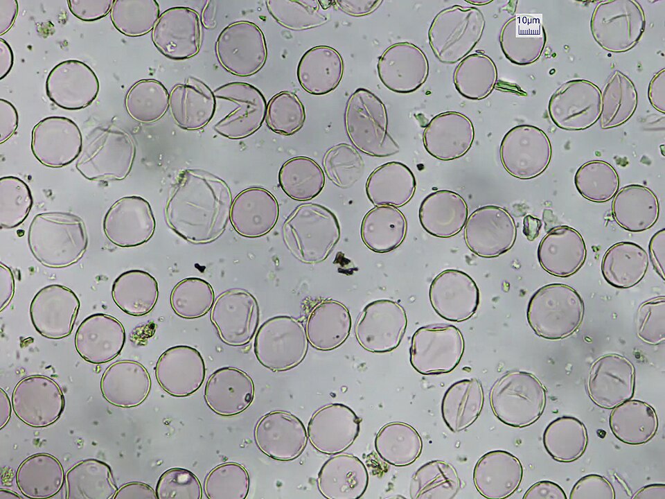 File:Urtica dioica pollen.jpg