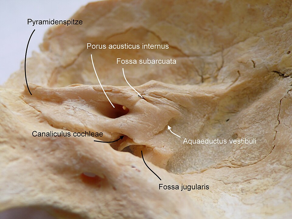 File:Temporal bone1.jpg