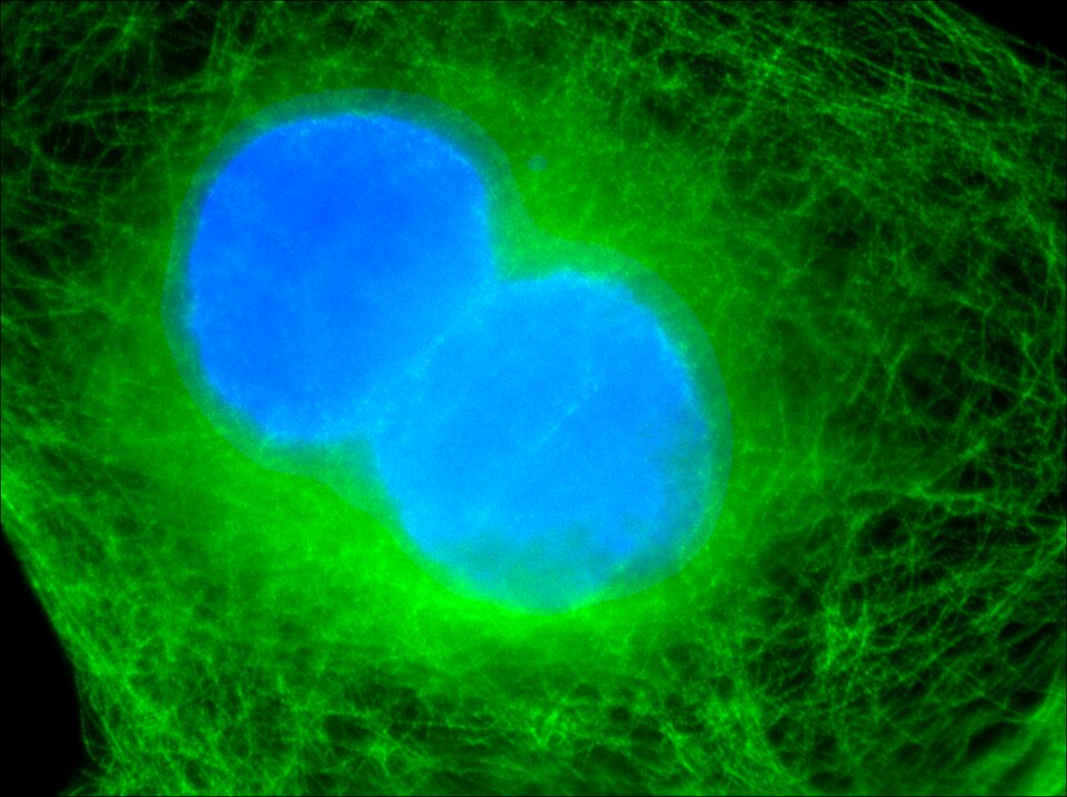File:Binucleated cell overlay.tiff