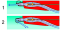 Thumbnail for version as of 00:47, 23 March 2008