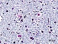 Bowdian stain 1
