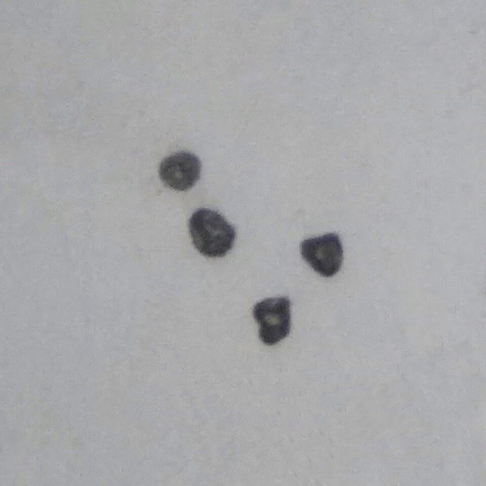 File:Pollens of Kyllinga brevifolia 2.jpg