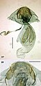 Female genitalia