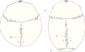 Top view of cranial suture.