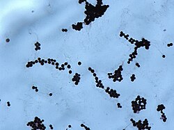 Cryptococcus neoformans a pathogenic yeast