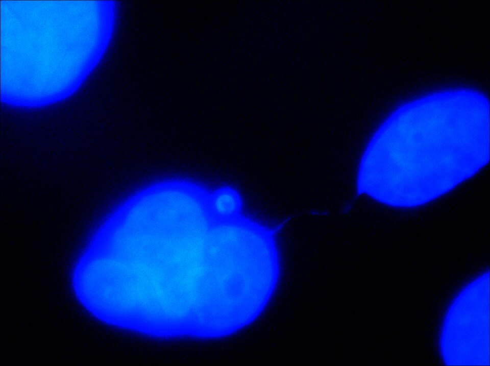 File:Chromatin bridge stained using DAPI 1.tiff