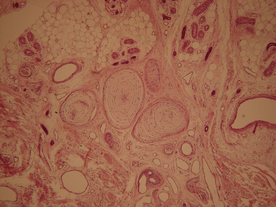 File:WVSOM Pacinian Corpuscle.JPG