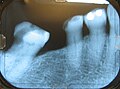 Thumbnail for version as of 12:57, 15 January 2010